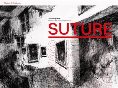 Suture Suture